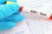 Epstein-Barr virus Might Increase Risk of Developing Seven Major Diseases