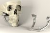 3D Printed Medical Implants Market